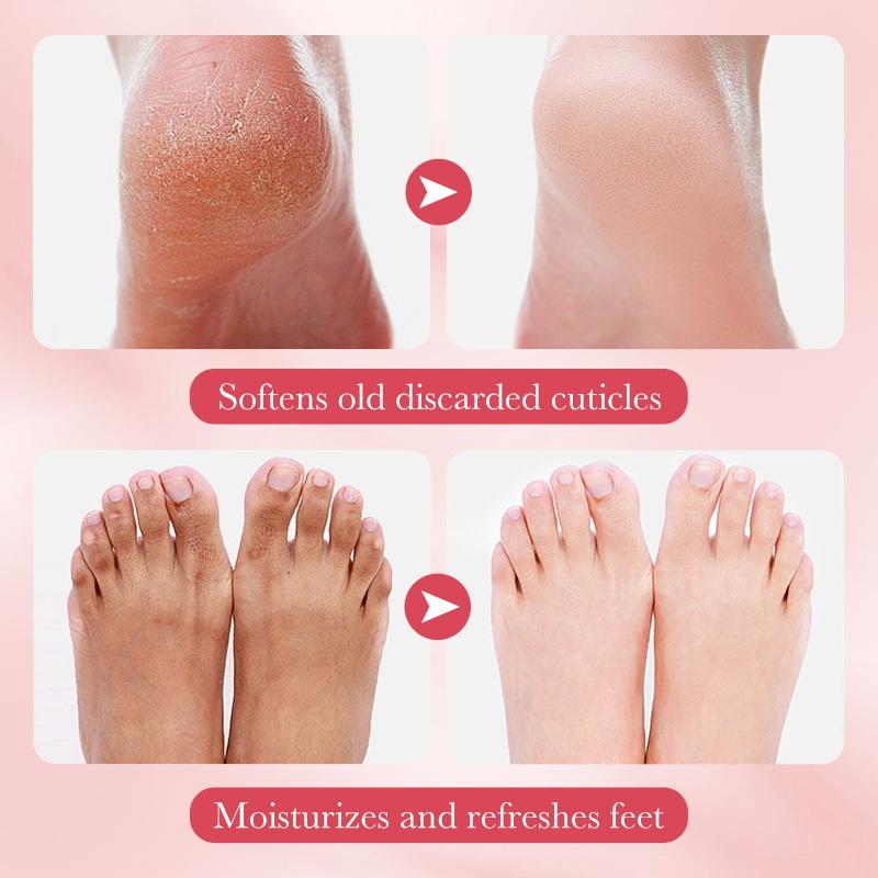 Foot Spa - 1ペア SADOER フルーツフットマスク 保湿フットピーリングマスク 角質除去 フットスパ